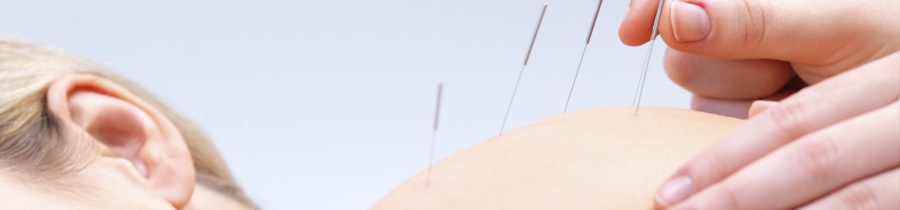 Acupuncture