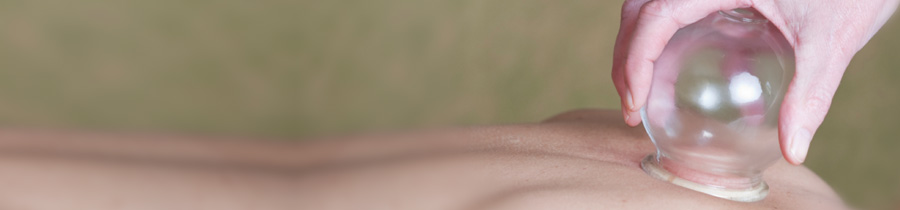 Cupping